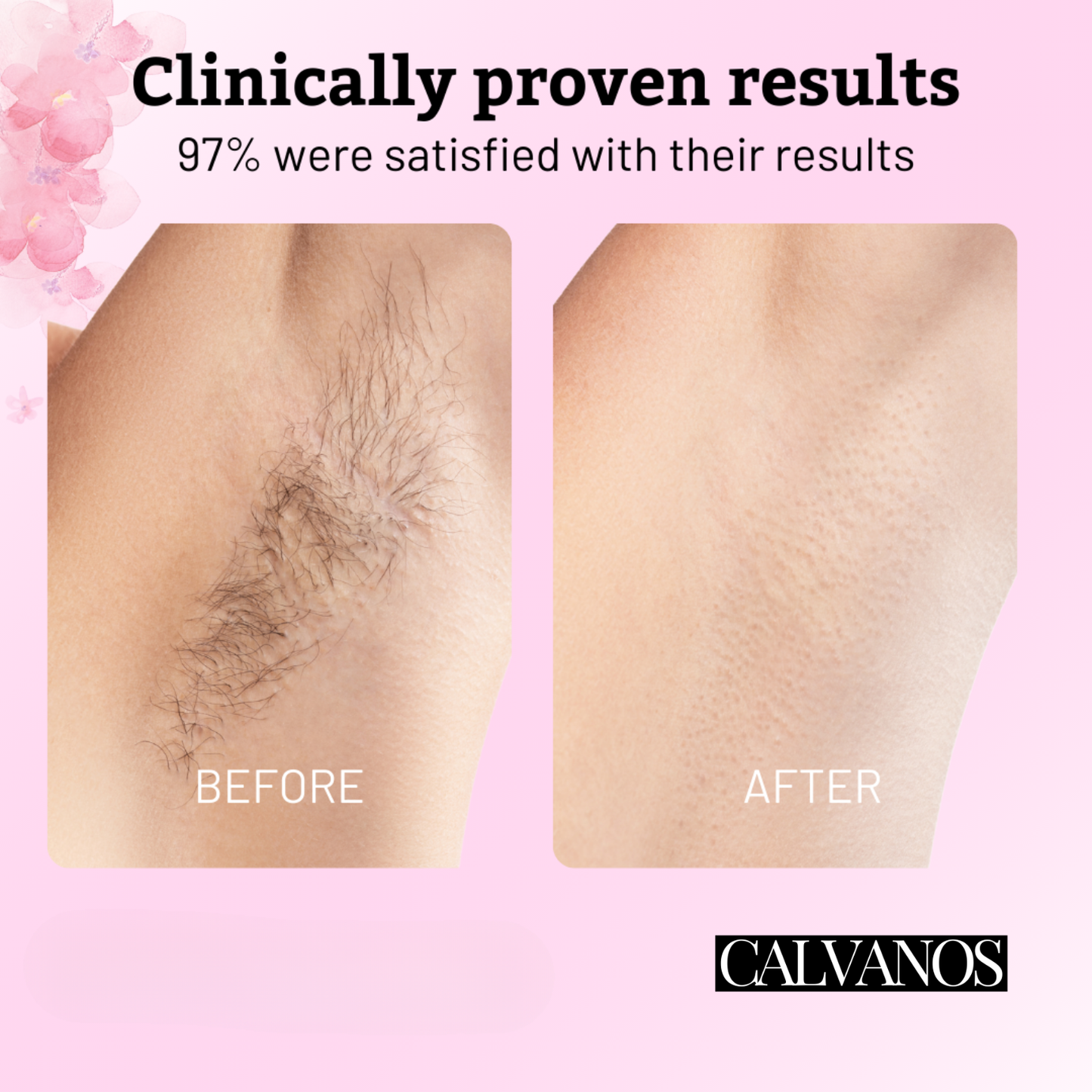 Calvanos Cyperus Rotundus Oil