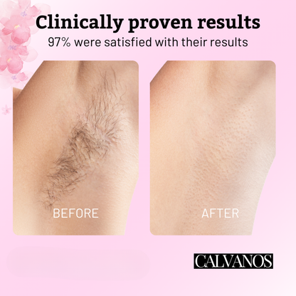 Calvanos Cyperus Rotundus Oil